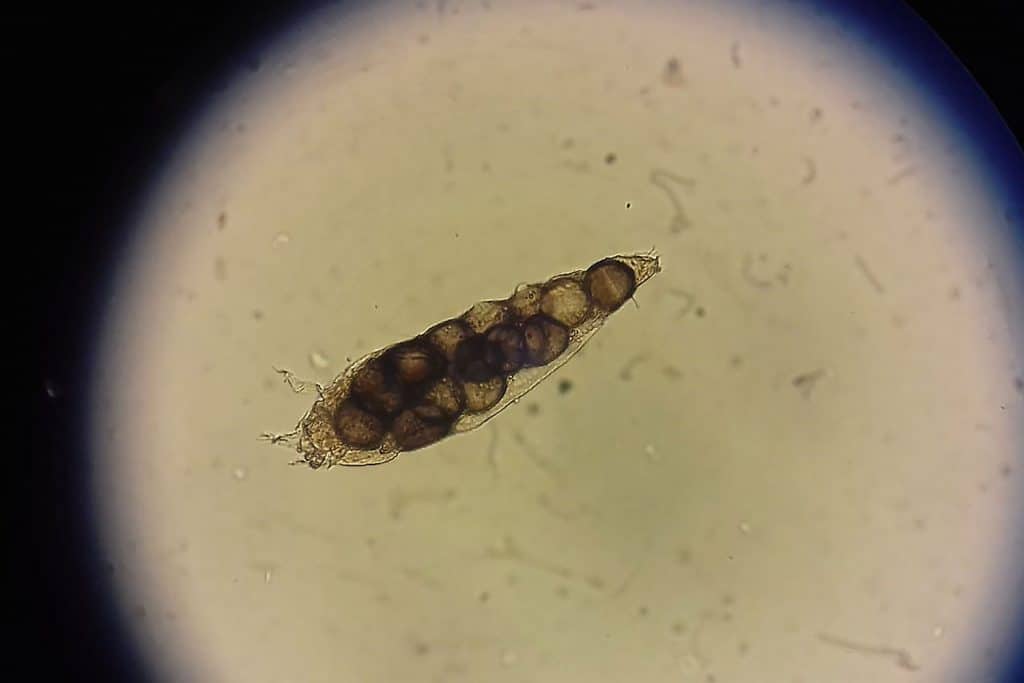 A microscopic view of a Demodex parasite